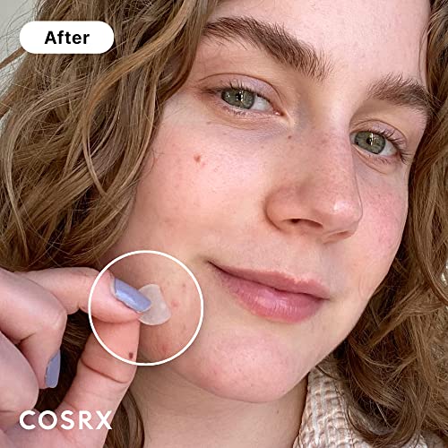 COSRX Acne Pimple Patch Absorbing Hydrocolloid Original 3 Size Patches for Blemishes and Zits Cover, Spot Stickers for Face and Body, Not Tested on Animals (240)