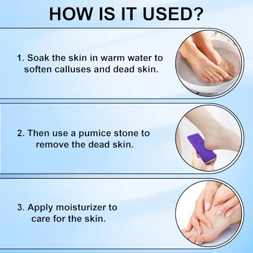 Purple Foot Pumice Stone 2 Pack for Callus Removal - Double Sided Pedicure Tool