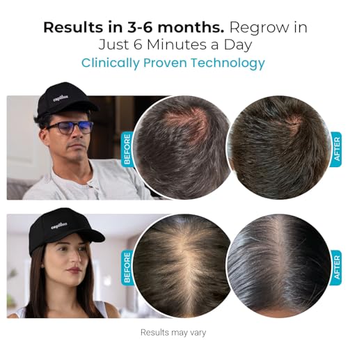 Capillus Spectrum 312 Laser Hair Growth Cap - FDA Cleared