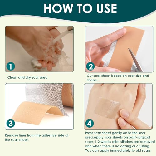 Silicone Scar Tape, Premium Silicone Gel Scar Sheets (1.6"x 60" Roll-1.5M), Reusable Silicone Patches, Soft Silicone Tape for Surgeries Scars, C-Sections, Wrinkles et