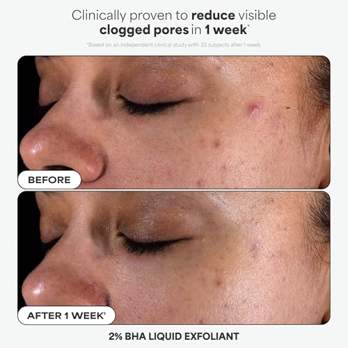 Paula's Choice Favorites Mini Kit, 4 Piece Set Includes 2% BHA Exfoliant, 1% Retinol Treatment, 10% Azelaic Acid Booster, Youth Extending SPF 50 Moisturizer, Travel Skin Care Set for Glowing Skin