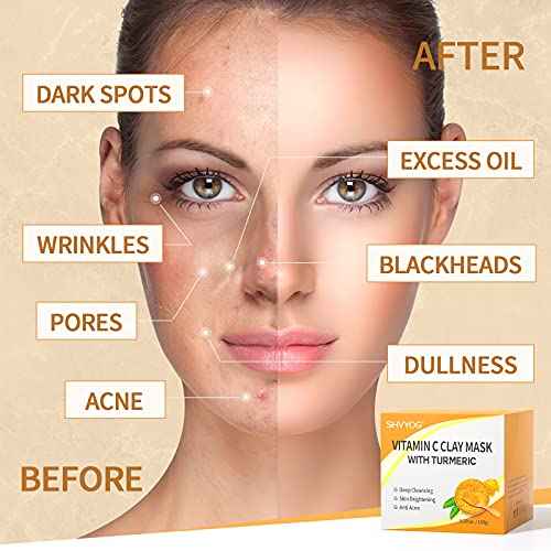 SHVYOG Vitamin C Face Mask with Kaolin Clay and Turmeric for Dark Spots, Dull Skin, Skincare Facial Mask for Controlling Oil and Refining Pores 5.29 Oz