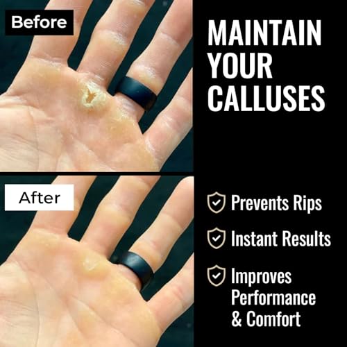 Callus Removal Kit for Hands - 4" File & Salve Balm