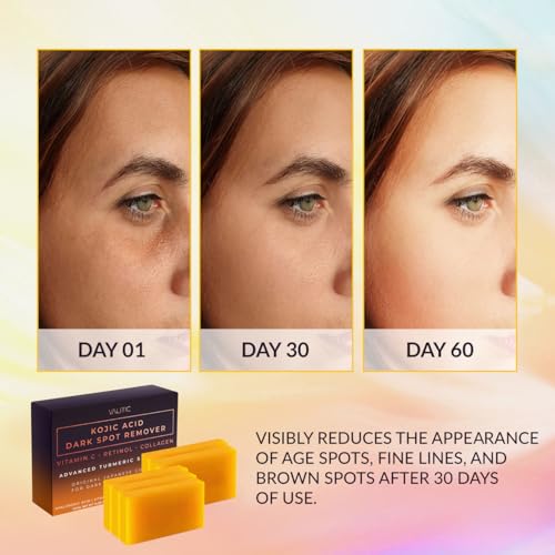 VALITIC Kojic Acid Dark Spot Remover Soap Bars 5 Pack with Turmeric – 3.52 oz ea