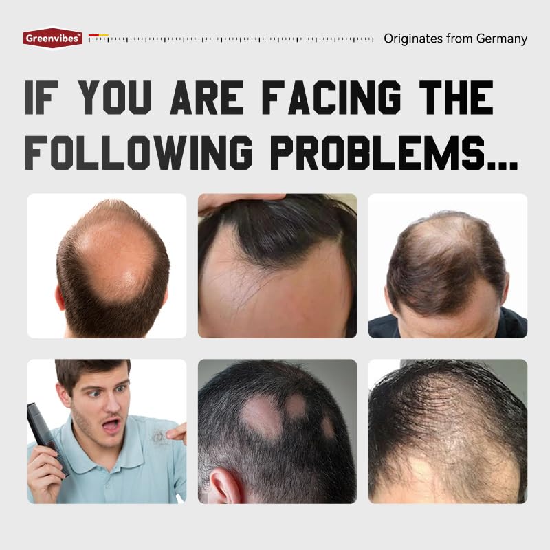 Hair Growth Spray for Thicker, Fuller Hair - Anti-Thinning Serum