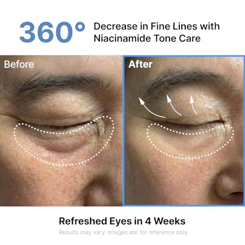 Silk Peptides EGF Eye Cream – Puffiness & Fine Lines