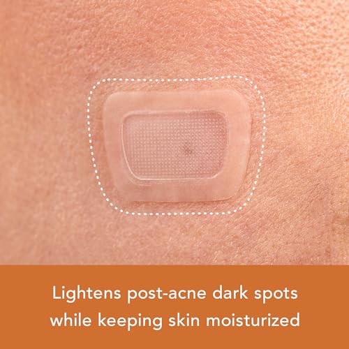 Rael Miracle Bundle - Microcrystal Dark Spot Cover (6 Count), Invisible Spot Cover (96 Count), Spot Control Cover (10 Count)