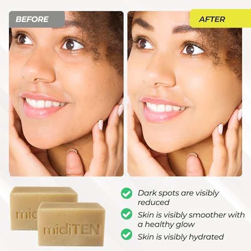 Kojic Acid Dark Spot Corrector Bar Soap ? With Alpha-arbutin, Hyaluronic Acid, Coconut Oil, Lemongrass Oil ? For All Skin Types ? Ultra Moisturizing ? All-Natural Ingredients (4OZ)