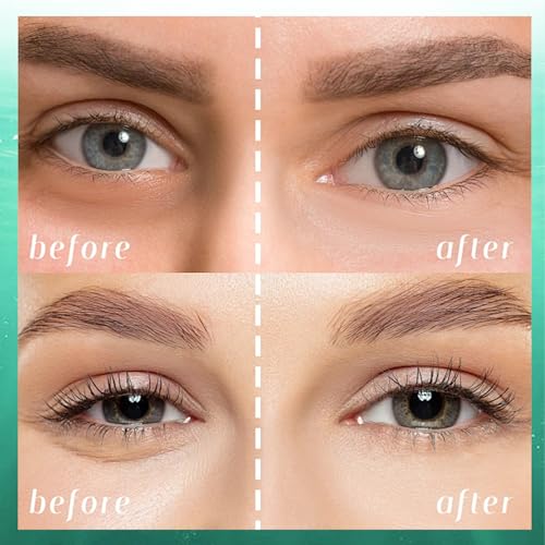 Firstfly 60 Avocado Eye Patches – Dark Circles & Puffiness Mask