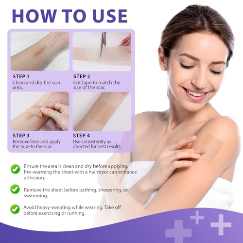 Silicone Scar Sheets, Silicone Scar Tape (1.6¡± x 60¡± Roll, 1.5M) ? Reusable Silicone Scar Sheets for Surgical Scars, C-Section, Keloids, Burns, Acne, and Keloid Bump Removal