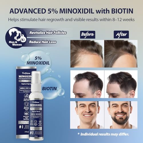 5% Minoxidil Hair Regrowth Spray for Men & Women - 2 oz