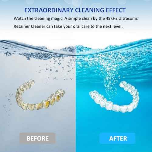 2025 Upgraded Ultrasonic Retainer Cleaner with Dryer Fan, 45kHz UV Ultrasonic Dental Cleaning Pod, Retainer Cleaner Machine for Dentures, Aligners, Mouth, Night Guards & Jewelry (White)
