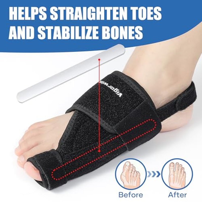 Bunion Corrector with Aluminum Bar – Day & Night Support for Men & Women