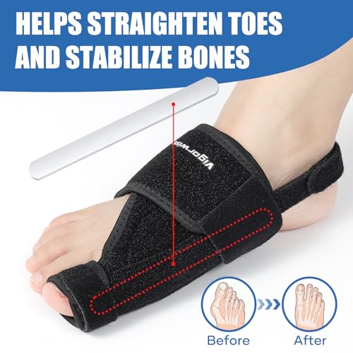 Bunion Corrector with Aluminum Bar – Day & Night Support for Men & Women