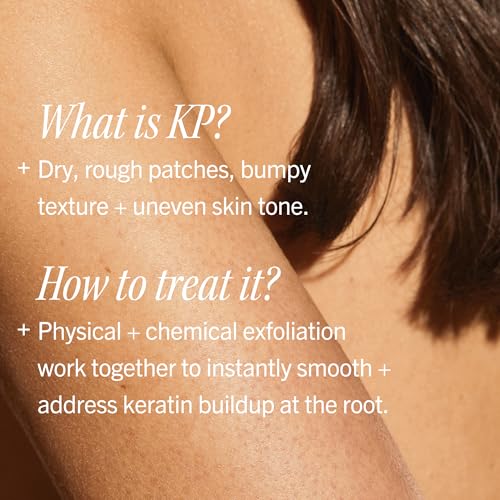 KP Bump Eraser Body Scrub with 10% AHA by First Aid Beauty