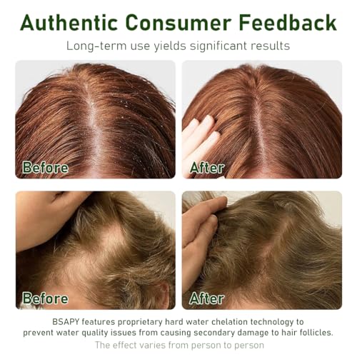Anti Hair Loss Shampoo Bar - DHT Blocker, 120g × 2