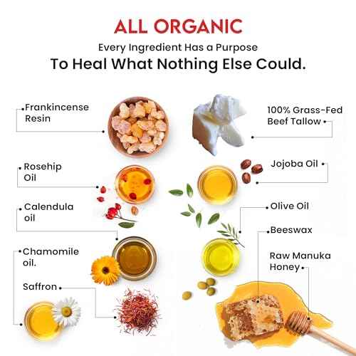 Whipped Tallow Honey Balm ? Grass-Fed Beef Tallow infused with Organic Manuka Honey, Rosehip, Jojoba & Olive Oils ? Nourishing Face, Neck & Body Lotion, 100% Organic (Frankincense Scent - 2 oz)