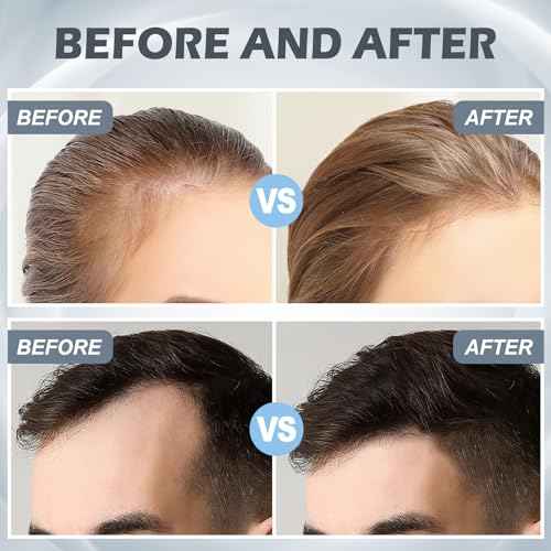 Derma Roller For Face Hair Beard,Beard Microneedle Roller,0.25mm Personal Use Microneedling Stamp Gifts For Men Women