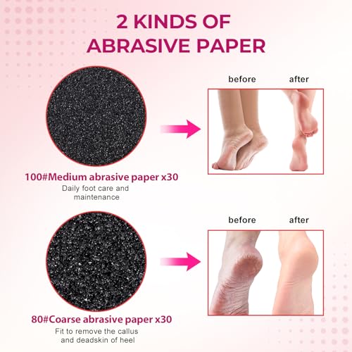 Replaceable Sandpaper Discs for Electric Foot File - 60 Pack (80/100 Grit)