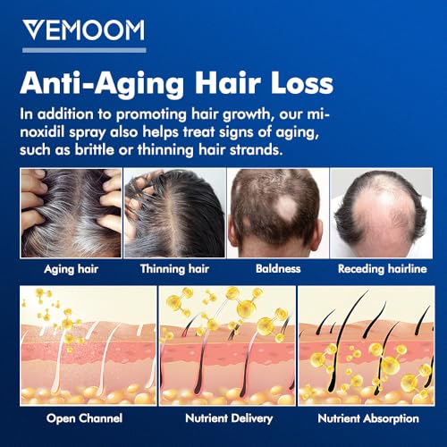 5% Minoxidil Hair Growth Spray for Women & Men - 60ml, Extra Strength Treatment for Thicker, Stronger Hair