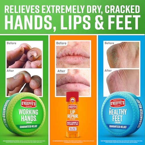 O'Keeffe's Giftbox Including Lip Repair with Cherry and Vitamin E Oil Stick,Working Hands Jar and Healthy Feet Jar,Gift Idea,(Pack of 2)