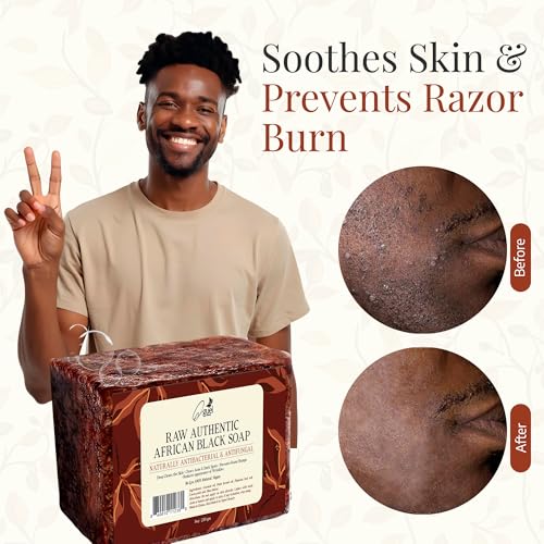 African Black Soap, 8oz, for Face and Body, with Shea Butter, Coconut Oil, Palm Kernel Oil, Cocoa Ash, Plantain Ash, Rich in Vitamin A & E