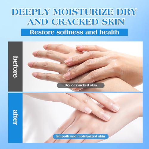 URQT 42% Urea Cream for Dry & Cracked Skin - Foot & Hand Moisturizer