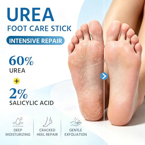 Mokasakiso 60% Urea Foot Cream Stick with 2% Salicylic Acid - Deep Moisturizing for Cracked Heels & Calluses