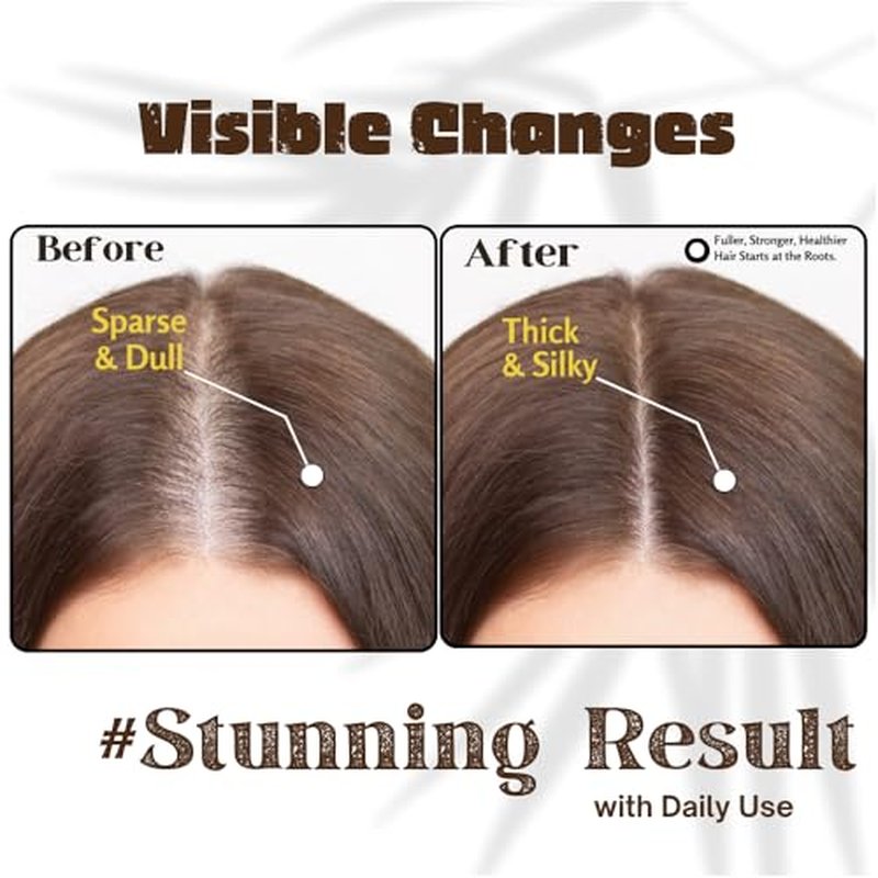 Rosemary Hair Growth Oil with Biotin & Vitamin E - 3.4 Fl Oz