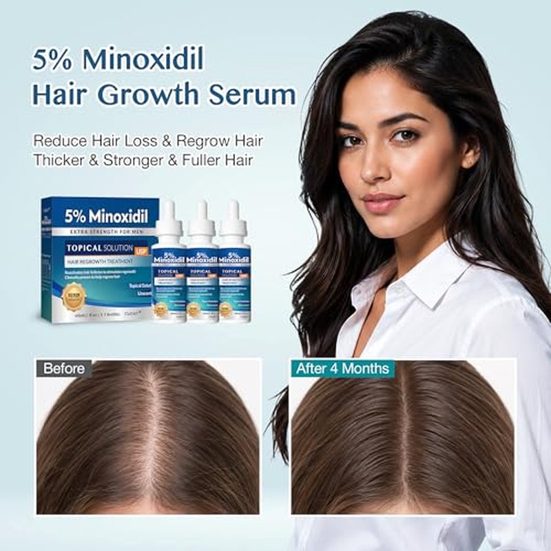 5% Minoxidil Hair Growth Serum for Men & Women 180ml