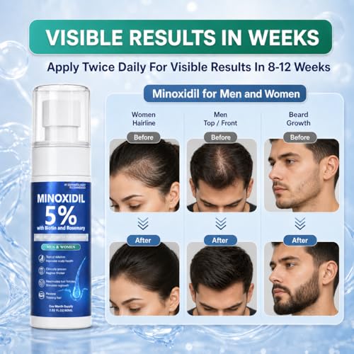 5% Minoxidil Hair Growth Serum for Men & Women, 60ML