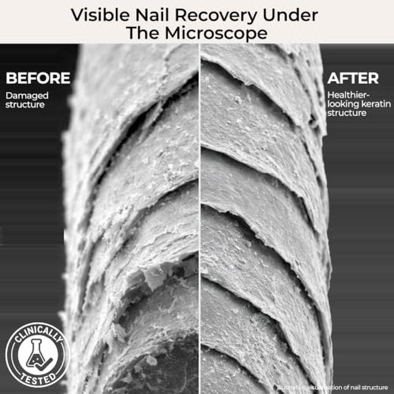 Nail Recovery Treatment for Gel & Acrylic Damage | Keratin Peptides