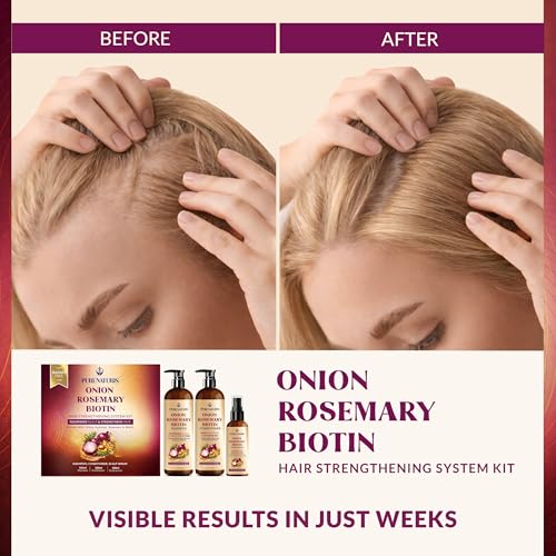 Onion Rosemary Biotin Hair Care Set – Shampoo, Conditioner & Scalp Serum