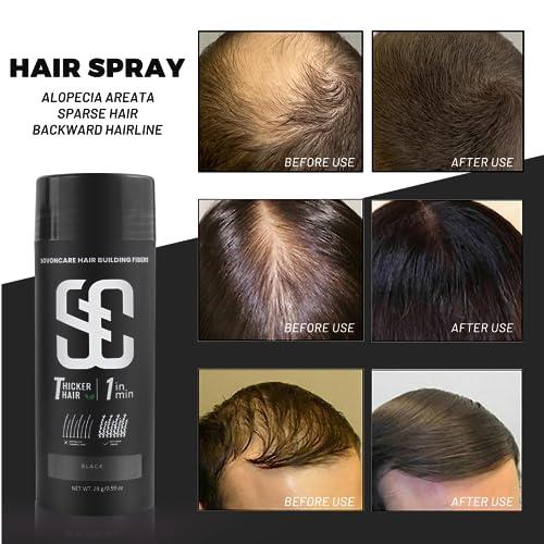 SOVONCARE Hair Fibers for Thinning Hair, Black 28g
