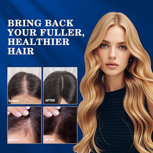 5% Minoxidil Hair Regrowth Spray for Men & Women