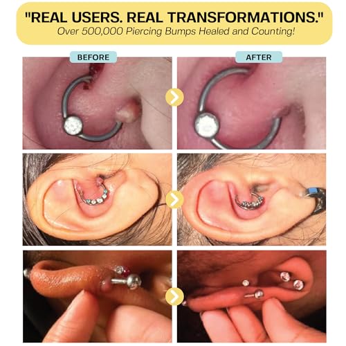 Keloid Bump Removal Gel - Natural Scar Treatment for Piercings