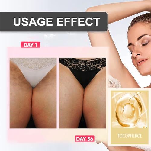 Crema para Aclarar las Axilas y Partes Intimas, Para Piel Entrepierna, Manchas Codos, Piernas Zonas, ?ntimas Cara Axilas, Rodillas Cuello 50G (4 bottles loci?n de cuidado de axilas y partes intimas)