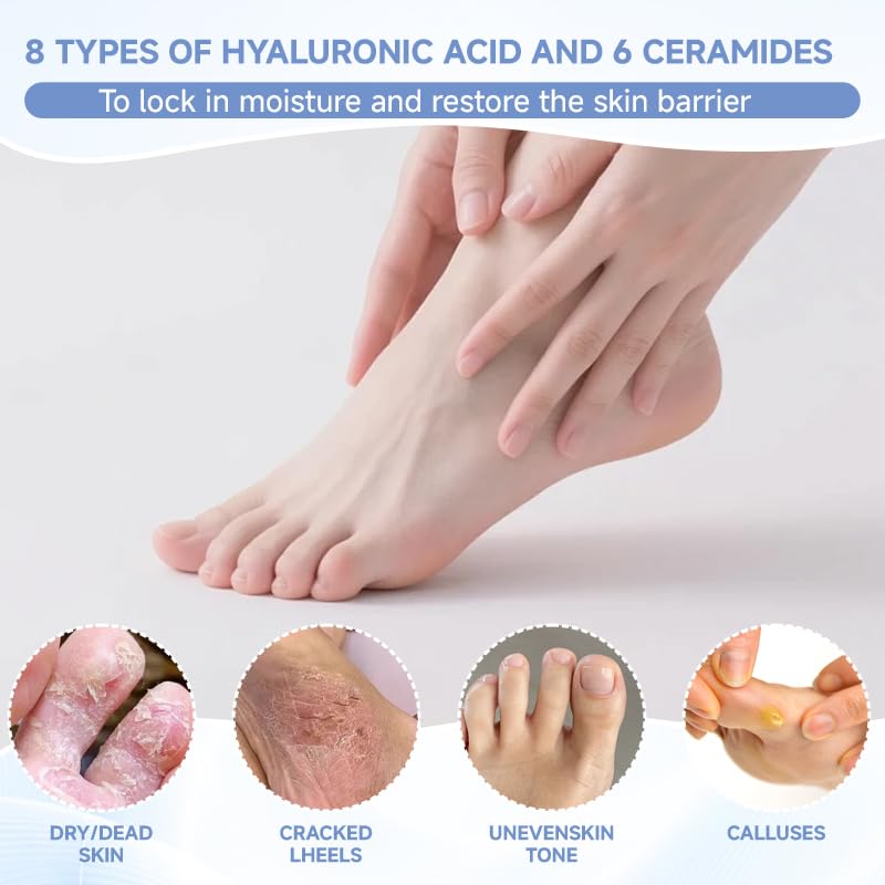 TrySafe PDRN & Collagen Foot Peel Mask for Dry Cracked Feet - 4 Pairs