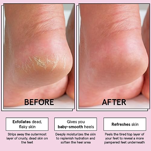 grace & stella Award-Winning Foot Peel Mask (2 Pairs, Lavender) - Foot Peeling Mask with Aloe Vera - Moisturizing Foot Mask for Dry Cracked Feet - Foot Exfoliator for Baby Soft Feet