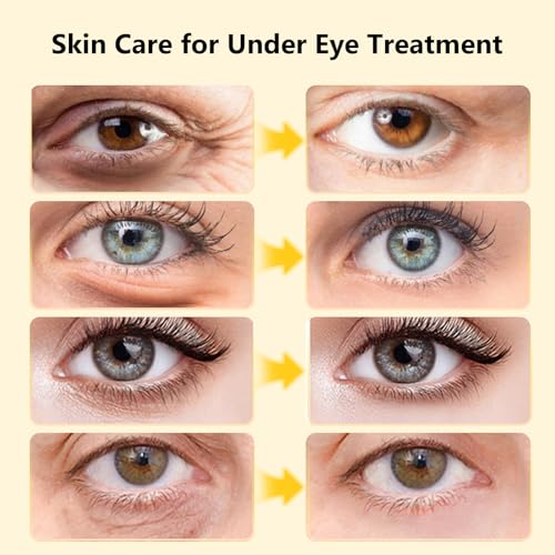 Adofect 24K Gold Under Eye Patches - 30 Pairs for Dark Circles
