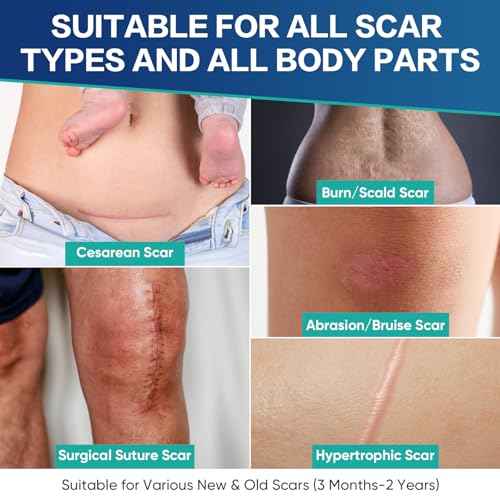 Medical Grade Silicone Scar Sheets, 20 Count (10x4 x4+10x1.2 x6) Dual-Size Scar Treatment for Surgical, Burn, Hypertrophic & Keloid Scars, Breathable & Discreet Strips