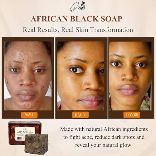 African Black Soap, 8oz, for Face and Body, with Shea Butter, Coconut Oil, Palm Kernel Oil, Cocoa Ash, Plantain Ash, Rich in Vitamin A & E