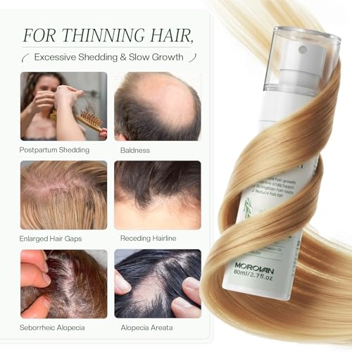 Morovan Hair Growth Spray - Batana & Castor Oil, 2.7 fl oz