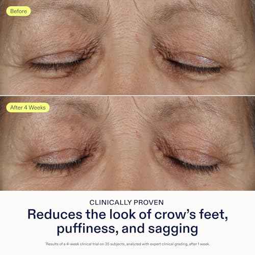 Skinfix Triple Lipid Eye Treatment - 0.5 fl oz - Eye Cream - Visibly Tightens, Depuffs & Smooths Undereyes - Non-Comedogenic - Fragrance Free - Vegan, Cruelty Free