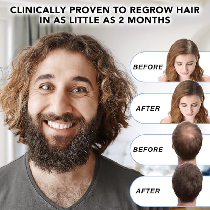 5% Minoxidil Hair Regrowth Serum with Dropper
