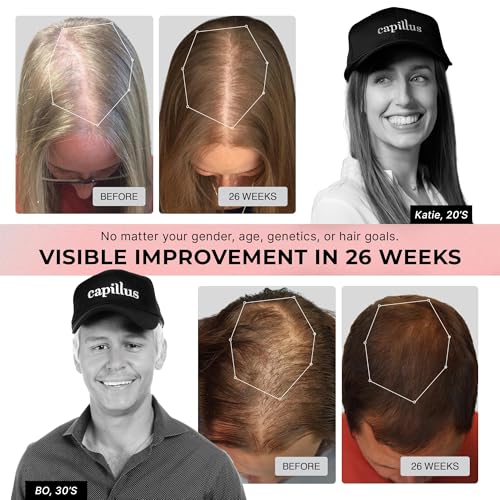 Capillus PRO S1 Laser Hair Growth Cap - FDA Cleared