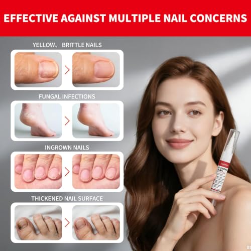 Toenail Fungus Treatment Pen - Fast-Acting Antifungal Repair