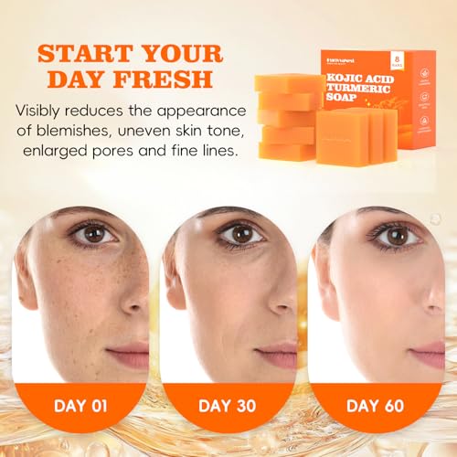 Turmeric Soap Bar Dark Spot Kojic Acid Soap Remover for face and body Even Skin Tone, Moisturizing & Nourishing Natural Ingredients 65g x 8 Bars