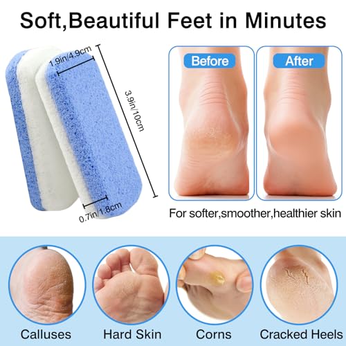 Dual-Sided Glass Pumice Stones for Callus Removal - 2-Pack