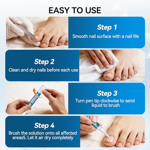 Maximum Strength Toenail Fungus Treatment Pen - 25% Undecylenic Acid, 4 Pens with Nail Files